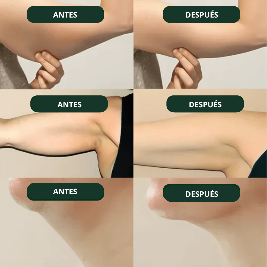 NatureDrops™️ | Dile adiós a la inflamación, siéntete más linda cada día
